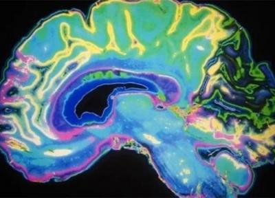 اختلال عملکردهای مهم مغز با نرم کننده ها
