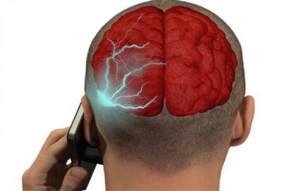 تاثیرات منفی اشعه های موبایل بر مغز